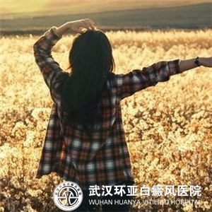 白癜风种类及相应症状