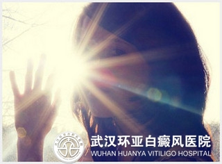 女性患上白癜风的原因有哪些