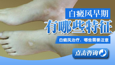 白癜风症状的表现有哪些