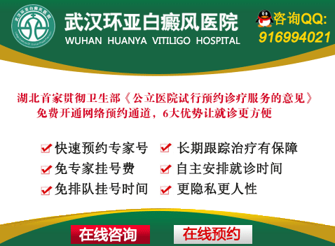 青少年白癜风治疗注意哪些