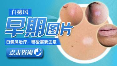手臂上出现一点小斑点会不会是患有白癜风