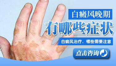白癜风晚期有什么症状表现