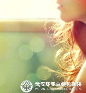 女性朋友应该怎么预防白癜风