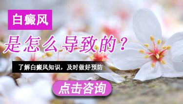 白癜风发病的起因是什么