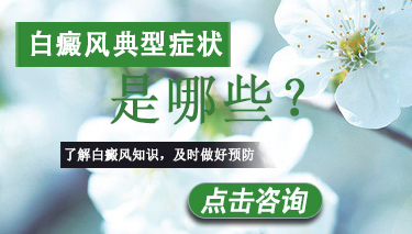 白癜风会有哪些典型症状