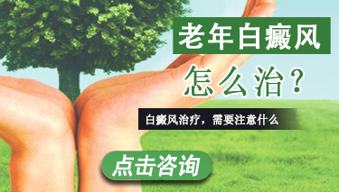 老人手部有白癜风怎么办