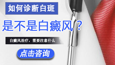 白癜风诊断需要注意哪些