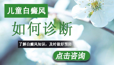 儿童白癜风该如何诊断