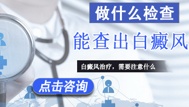 得了白癜风要做哪些检查事项