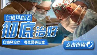 白癜风是否有治疗方法