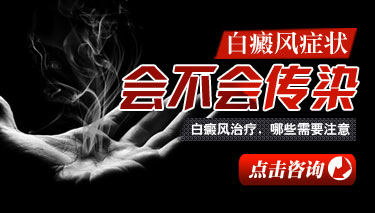 得了白癜风会不会传染