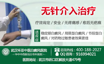 湖北白癜风哪里医院治疗好
