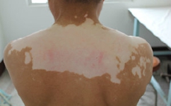 武汉有白癜风医院吗