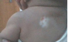 白癜风养身措施有哪些