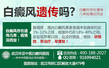 黄冈白癜风哪家效果好