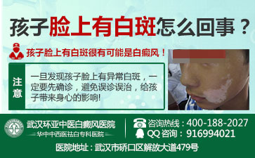 孝感哪个医院治疗白癜风好