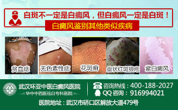 武汉哪个白癜风医院比较好
