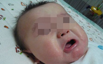 ¶ùͯ°×ñ°·çÈçºÎÔ¤·À²ÅºÃ