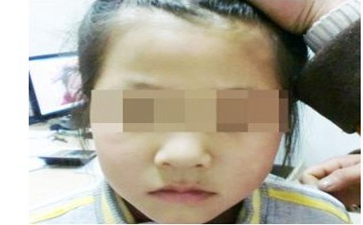 白癜风不吃药能好吗