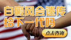 白癜风会遗传给孩子吗