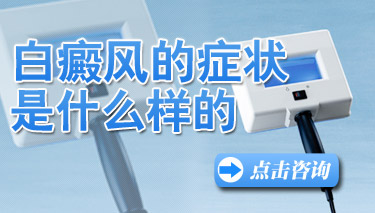 白癜风病发时会呈现什么症状