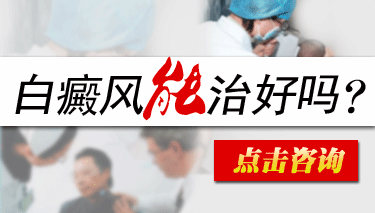 白癜风能彻底的治好吗
